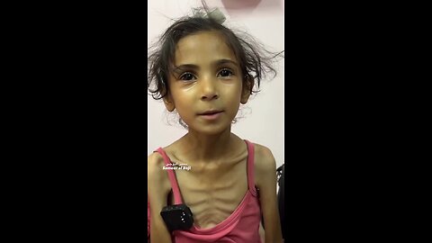 The seven-year-old girl, Amal Al-Bayouk, is suffering from severe malnutrition in Gaza