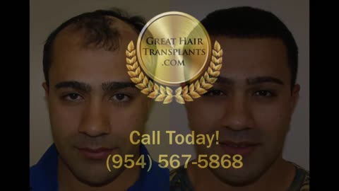 MaxHarvest™ Plus Transformation – Patient Adrian with Dr. Brett Bolton