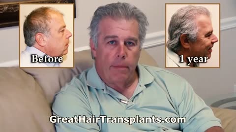 New York City’s Best Hair Transplant Results by Dr. Brett Bolton – Promo