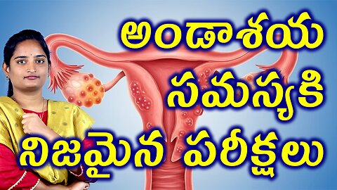 అండాశయ సమస్యకి నిజమైన పరీక్షలు Tests For Ovary Bubble, Ovarian Cyst Homeopathy Treatment Medicine