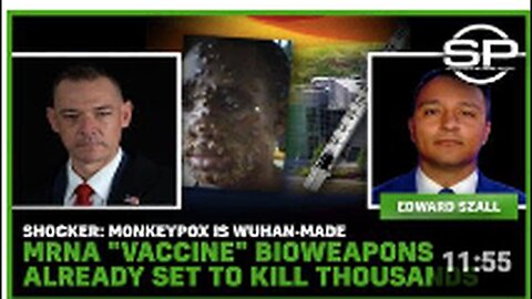 "Wuhan-Created Monkeypox: MRNA Bioweapons Set to Cause Thousands of Fatalities"