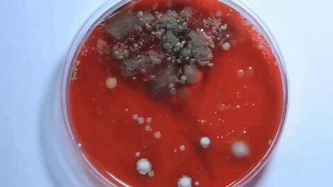 "Unmasking the Failed Germ Theory Hypothesis: Tuberculosis as a Prime Example"