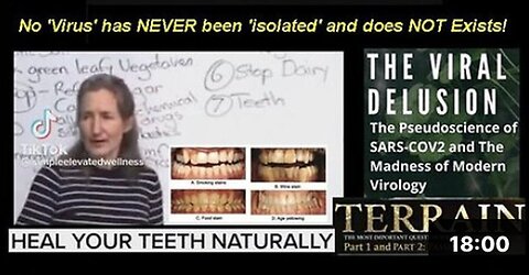 "Healing Teeth Naturally: A Guide by Barbara O'Neill (Australia)"