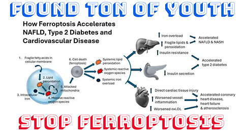 Cell Mechanisms to Stop Ferroptosis INSULIN RESISTANCE with C15 Fatty Acid Dr, Stephanie Venn-Watson