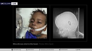 Gaza’s Wounds Speak: Children Deliberately Targeted | UK Column News