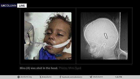 Gaza’s Wounds Speak: Children Deliberately Targeted | UK Column News