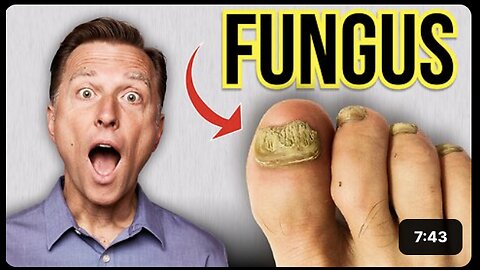How to Get Rid of Toenail Fungus Fast!