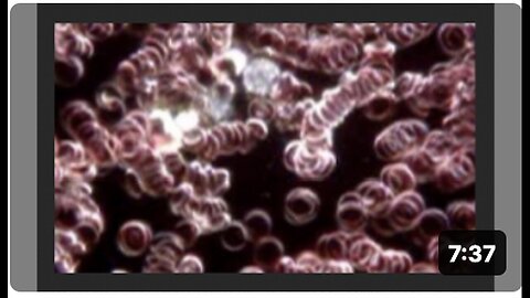 "Chlorine Dioxide Therapy: Live Blood Analysis with ClO2 at AndreasKalcker.com"