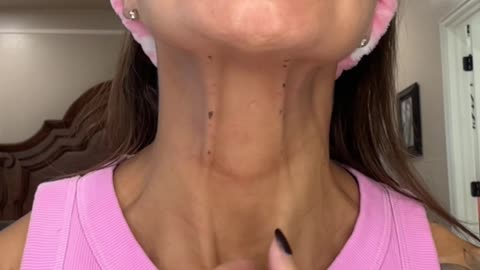 Botox touch up with Botulax