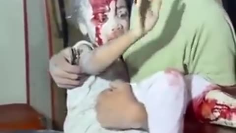 The scenes continue to be HORRIFIC in Gaza