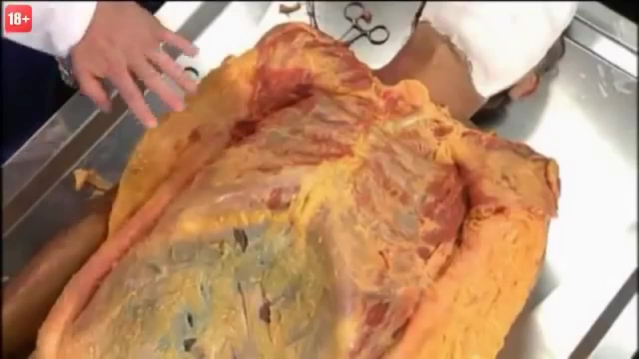 UKŁAD KRĄŻENIA dokument pl