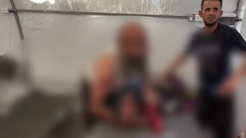 🇵🇸 A Palestinian child in Gaza City has lost one of his legs due to a brutal Israeli airstrike.