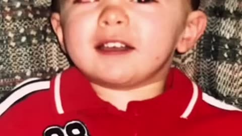 WHEN I LOST MY EYEBALL