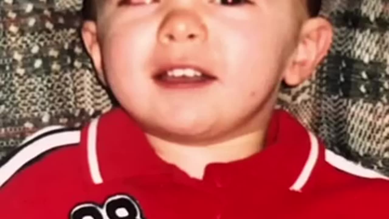 WHEN I LOST MY EYEBALL