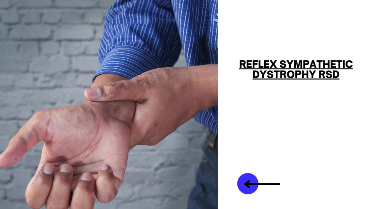 What is CRPS? Understanding the Basics