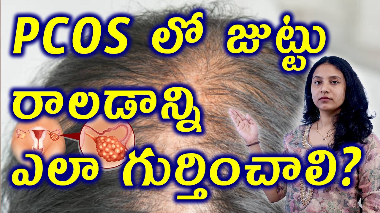 PCOS లో జుట్టు రాలడాన్ని ఎలా గుర్తించాలి? | Signs of PCOS Hair Fall in Women Treatment Medicine Cure