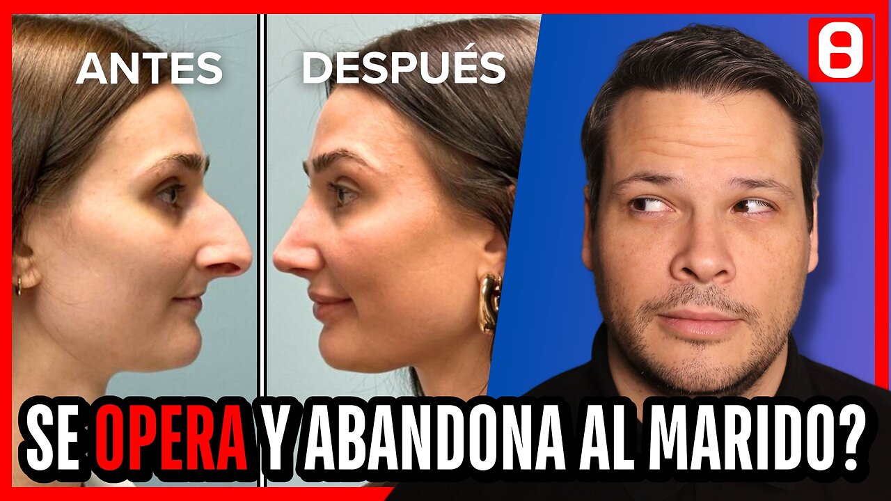 Los rasgos ocultos de las BELLEZAS OPERADAS