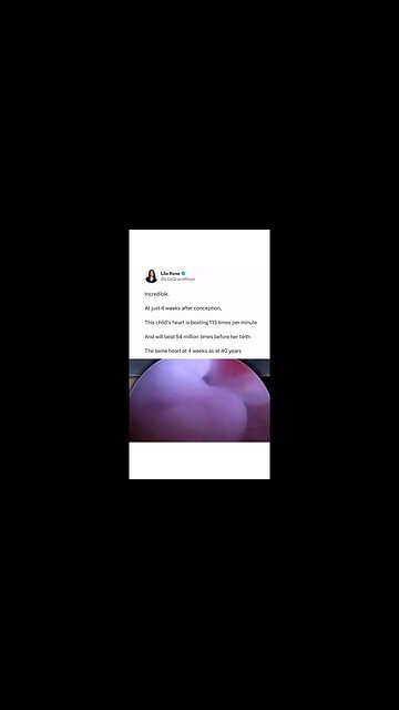 Human life is a miracle