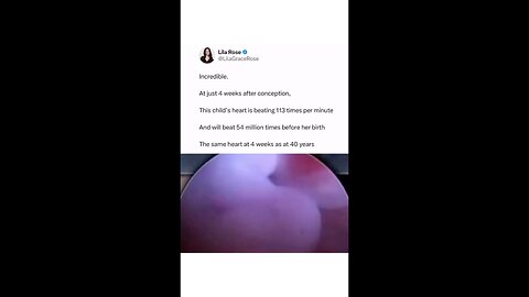 Human life is a miracle