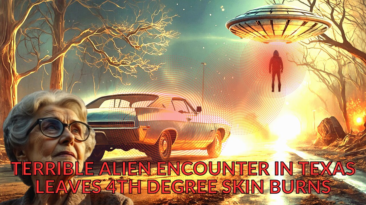 TERRIBLE ALIEN ENCOUNTER IN TEXAS LEAVES 4TH DEGREE SKIN BURNS