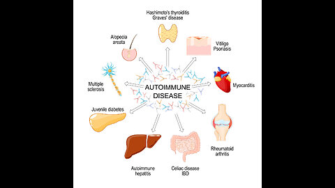 1% Tribe - Autoimmune diseases holistic approaches to set you on the right path.