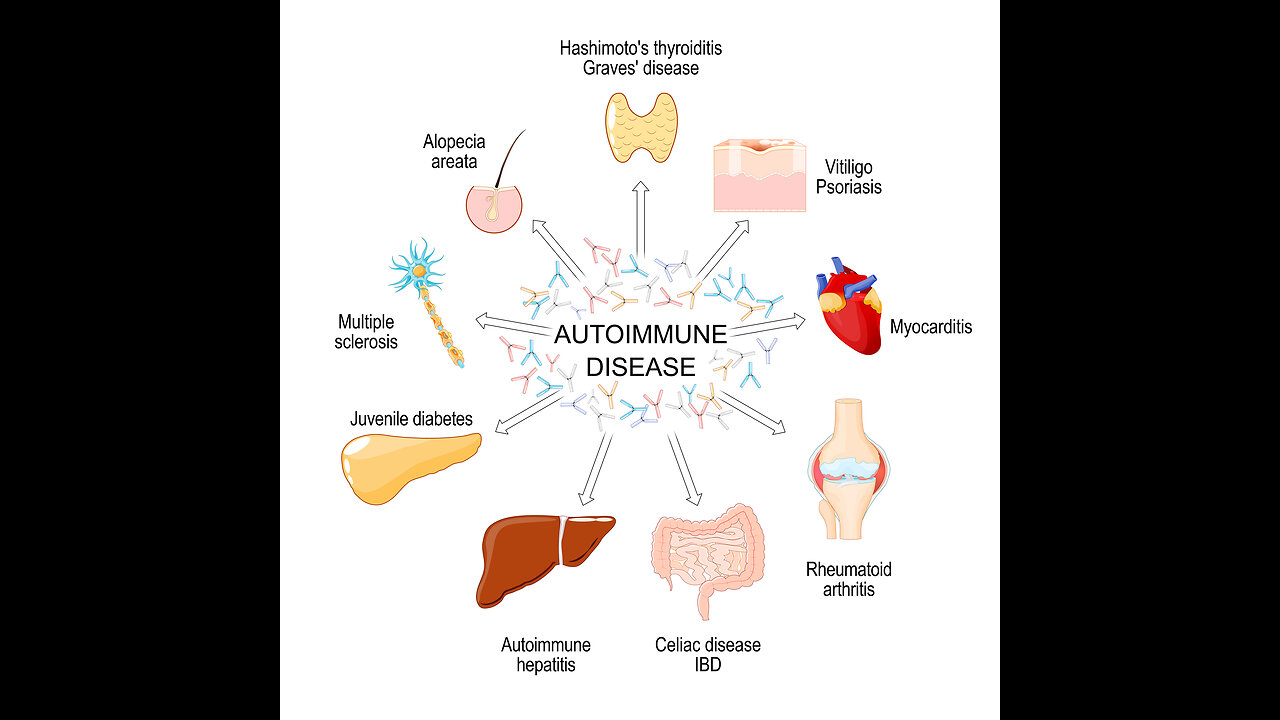 1% Tribe - Autoimmune diseases holistic approaches to set you on the right path.