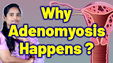 Know About Adenomyosis In Women | Internal Endometriosis, Painful Bulky Uterus | Cure Gynaecology
