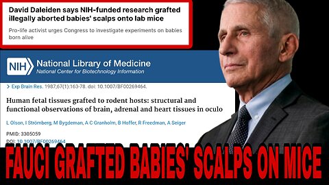 Fauci Grafted Illegally Aborted Babies' Scalps onto the Backs of Lab Mice - "Yes, It's True"