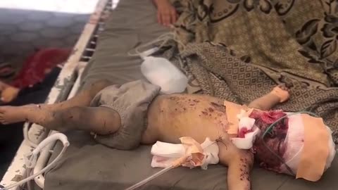 A baby was rescued from the rubble of his family’s home which was bombed in Gaza City