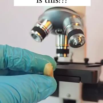 Fast food is loaded with parasites