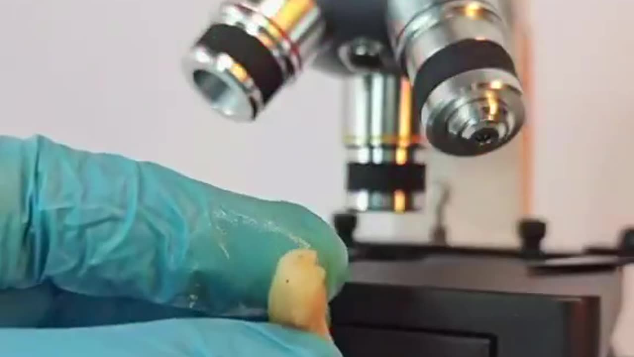 Fast food is loaded with parasites