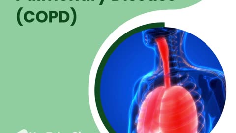 Breathe Easy: Understanding #COPD #StemCellTherapy & #LungHealth