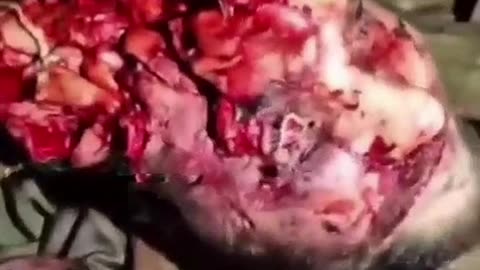 Caught an FPV drone with my face. No brain damage