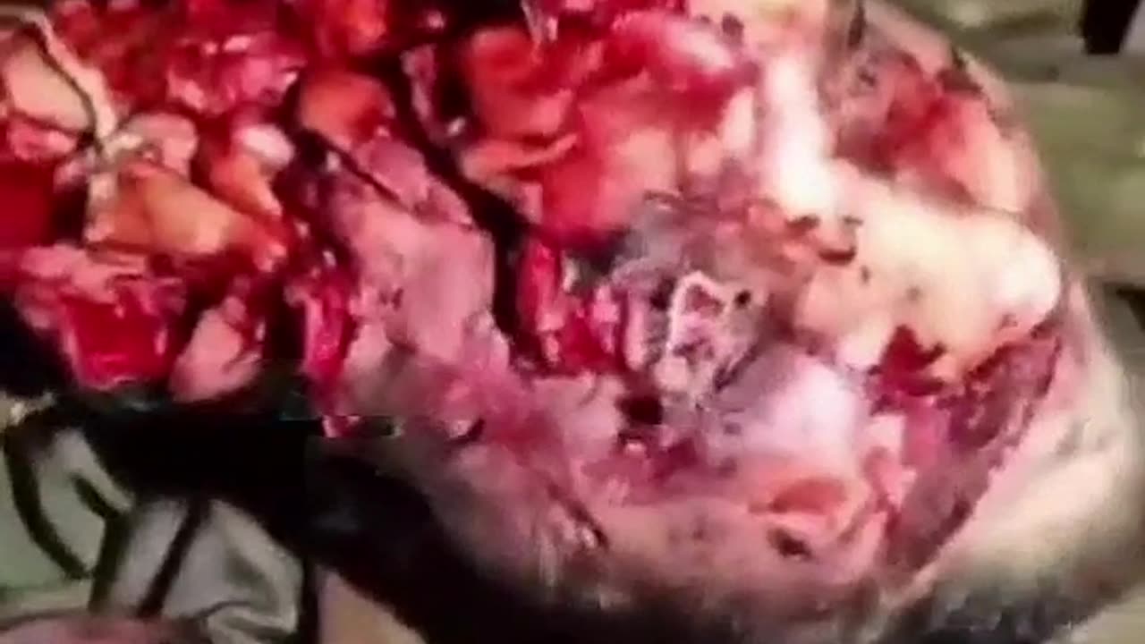 Caught an FPV drone with my face. No brain damage