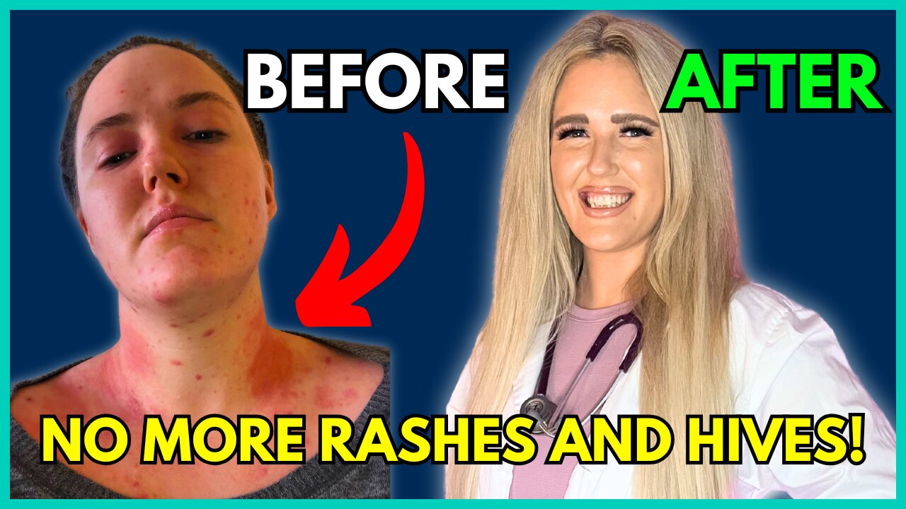 How to HEAL Histamine Intolerance Naturally!