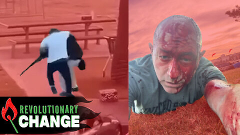 Here's Why Bondi Beach Is Israel's Latest FALSE FLAG..