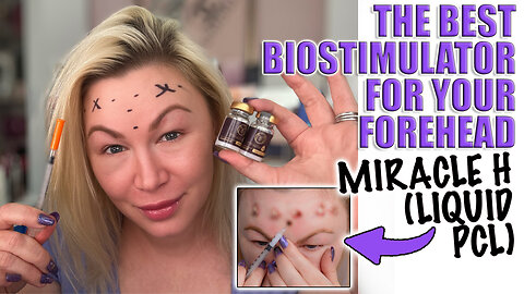 The BEST Biostimulator for Your Forehead, Miracle H (Liquid PCL), ACeCosm.com code Jessica10 saves