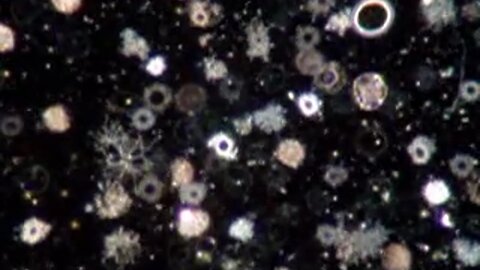 "Live Blood Analysis of Cancer Using Dark Field Microscopy"