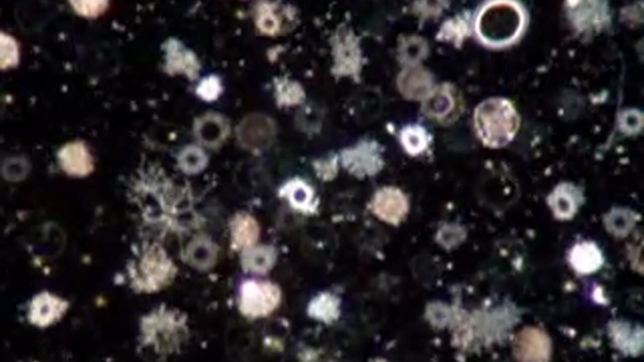 "Live Blood Analysis of Cancer Using Dark Field Microscopy"