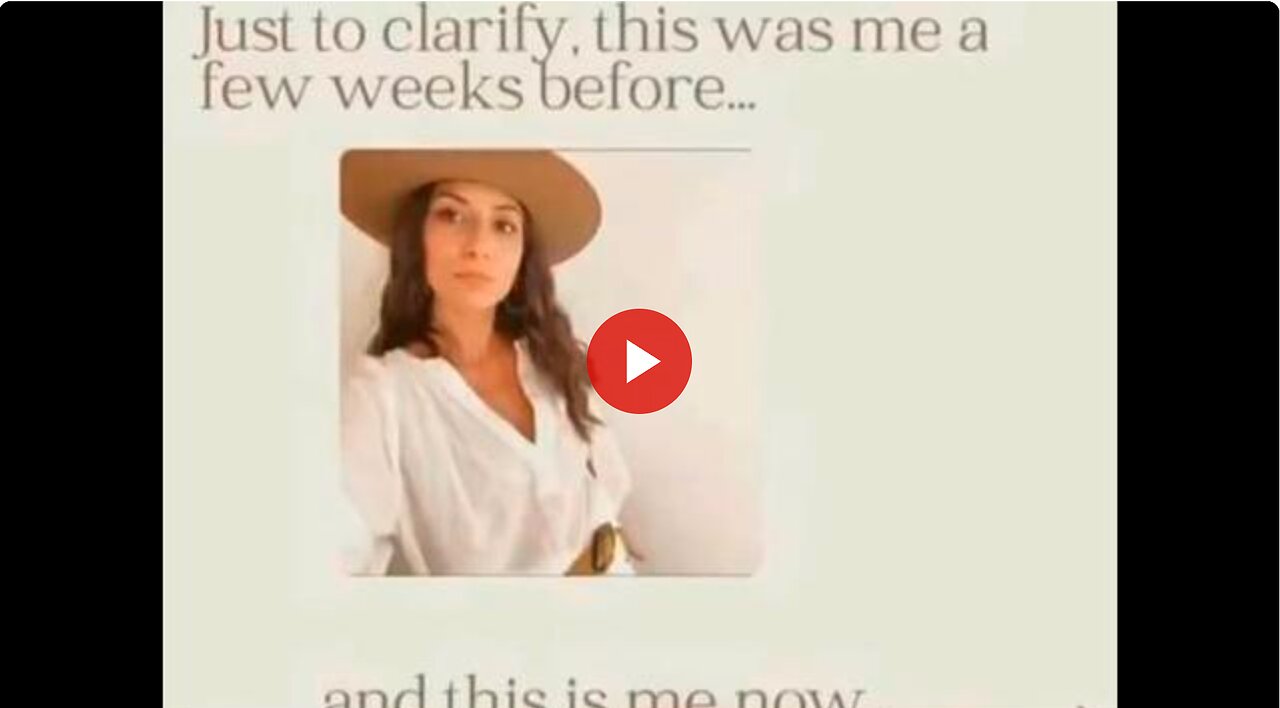 She says "This used to be me, now look what I have become". Extreme vaccine damage.