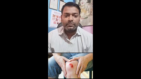 घाव ठीक न हो तो ये जांच कराएं ।