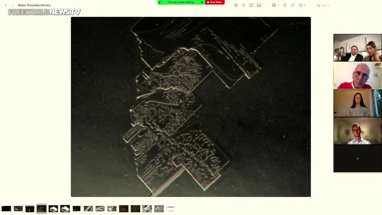 German Scientists Show Magnified Images Vaccine Damage and Unnatural Contaminants In Vaccines