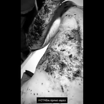 I don't know what to say