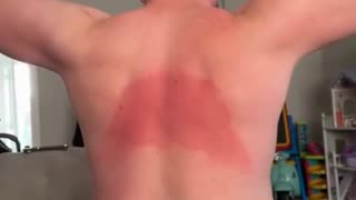 😂🌞 You Won't Believe This Sunlotion Blind Spot Fail! | FunFM