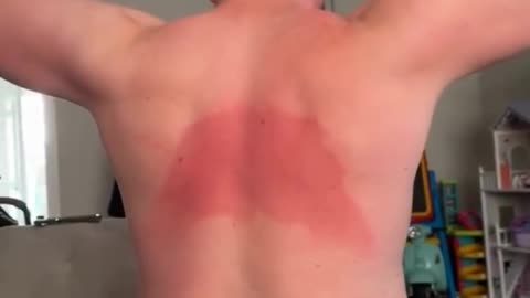 😂🌞 You Won't Believe This Sunlotion Blind Spot Fail! | FunFM