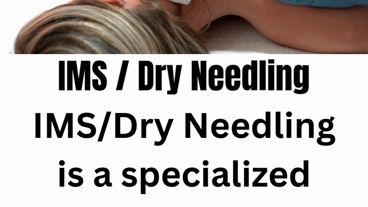 IMS / Dry Needling Therapy | Golden Maple Physiotherapy Maple Ridge