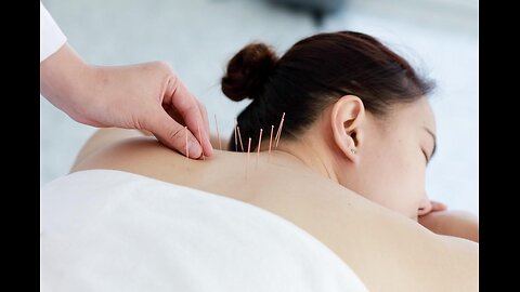Acupuncture Treatment in Toronto: Simple and Natural Way to Feel Better