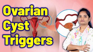 Risk Factors & Causes Of Ovarian Cyst, Hemorrhagic Ovarian Cyst, Ovary Cyst | Homeopathy Medicine