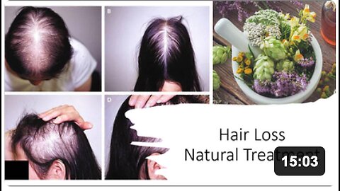 Hair Loss Natural Treatment