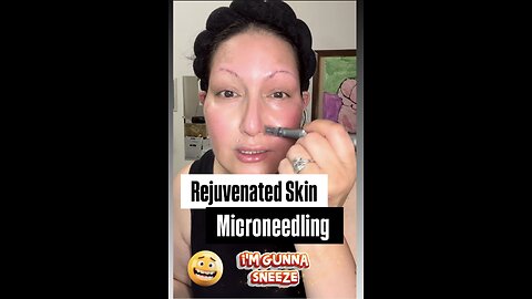 Rejuvenated Skin Microneedling With Exosomes & Stem Cells 💁🏻‍♀️Acecosm - Beautiejunkie10
